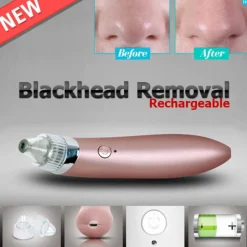 ASPIRATORE RIMUOVERE PUNTI NERI AD ULTRASUONI PULIZIA VISO FACCIALE PORTATILE