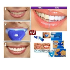 KIT TRATTAMENTO SBIANCANTE DENTI WHITELIGHT E LAMPADA PLASMA UV TARTARO GEL